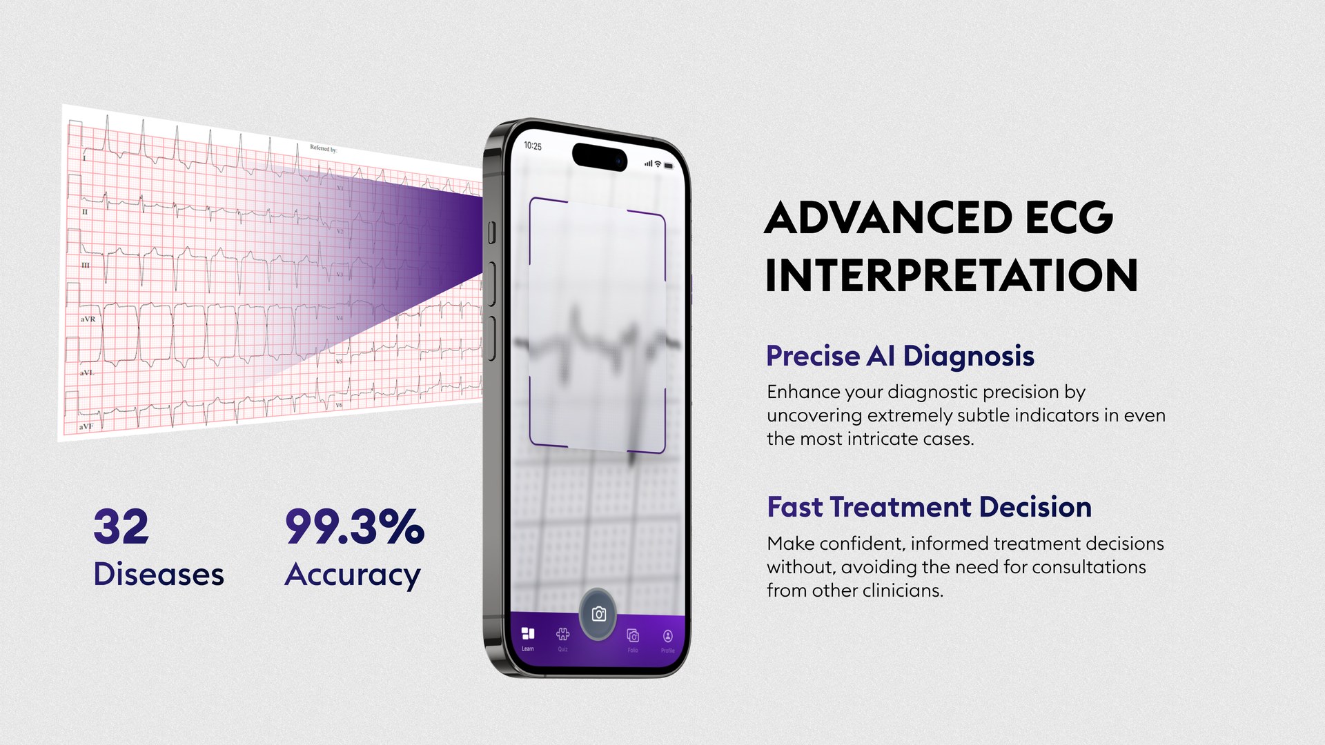 Advanced ECG interpretation: a paper ECG scanned by a phone, with the headings Precise AI Diagnosis and Fast Treatment Decision