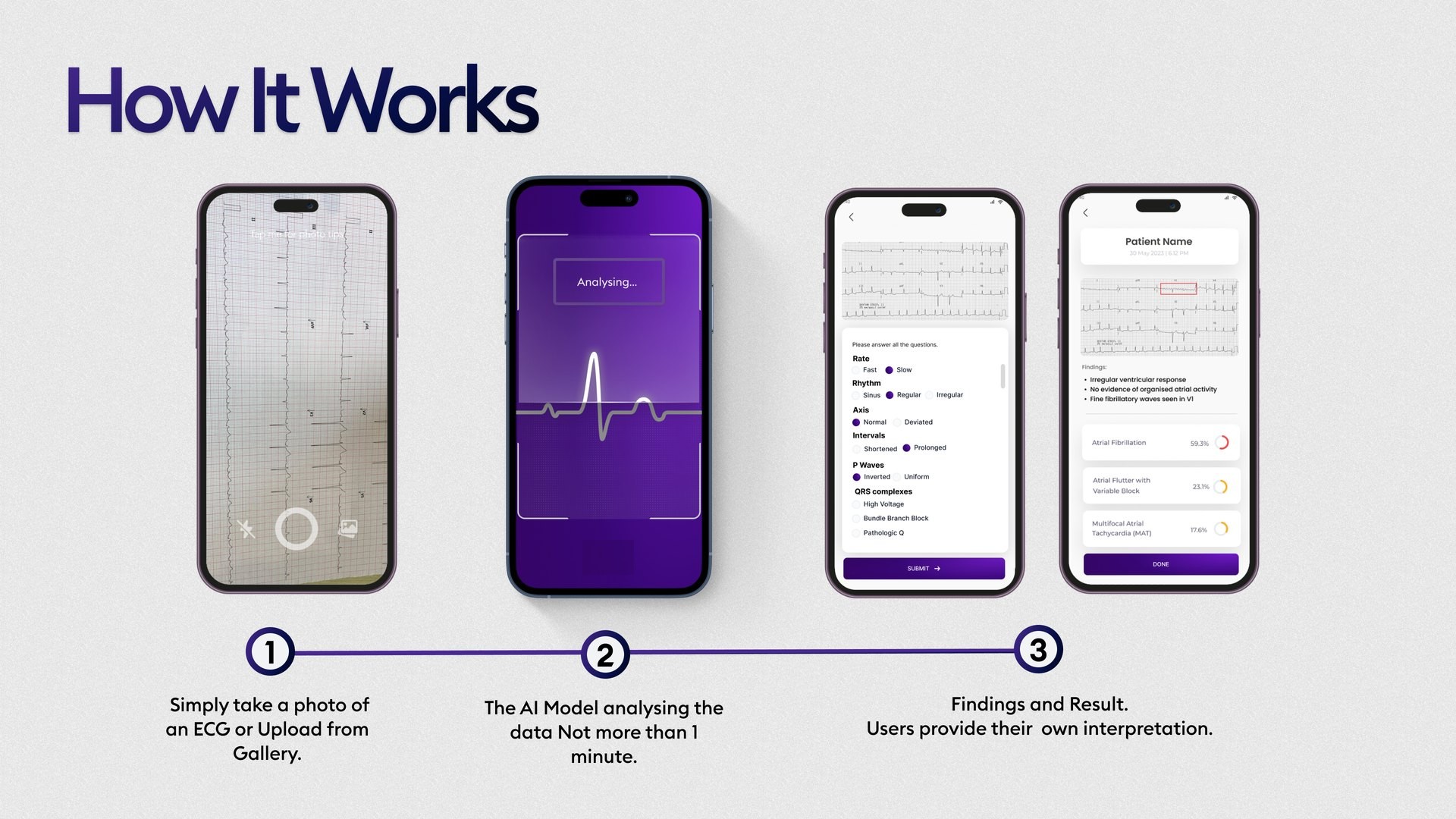 How ECG Sense works, in four phone screens: photograph the ECG, the model analyses it, the clinician answers interpretation questions, and the findings appear with confidence scores